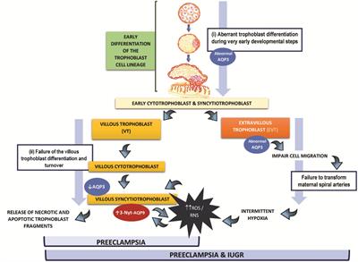 New Insights Into the Role of Placental Aquaporins and the Pathogenesis of Preeclampsia